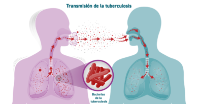 30 de Agosto: TUBERCULOSIS: CONFIRMAN DOS CASOS PEDIÁTRICOS EN 30 DE AGOSTO