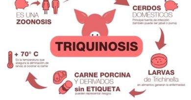 Brote de triquinosis en Madariaga: más de 100 personas afectadas, dos graves